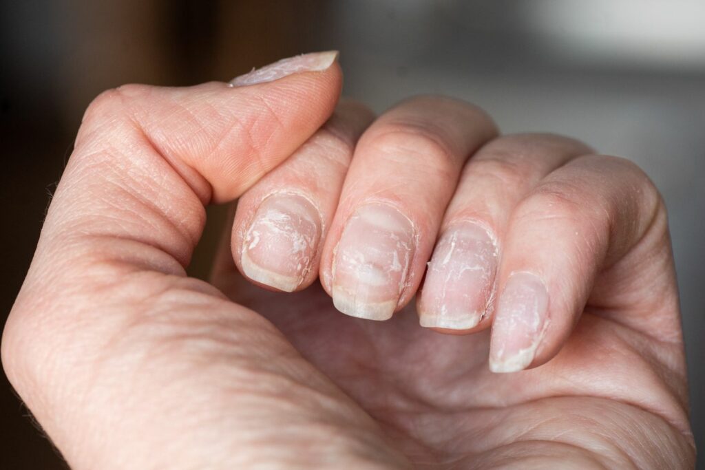 5 Nail Care Mistakes