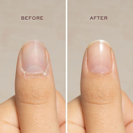 Not moisturizing your nails and cuticles Not moisturizing your nails and cuticles